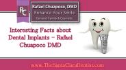 Interesting Facts about Dental Implants - Rafael Chuapoco DMD