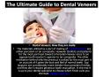 The Ultimate Guide To Dental Veneers PowerPoint PPT Presentation