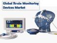 Global Brain Monitoring Devices Market PowerPoint PPT Presentation