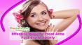 Effective Ways To Treat Acne Fast And Naturally PowerPoint PPT Presentation