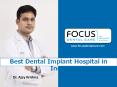 Dental Implants Specialist India - Focus Dental Treatments PowerPoint PPT Presentation