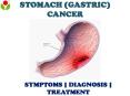 Stomach (Gastric) Cancer: Overview of symptoms, diagnosis and treatment PowerPoint PPT Presentation