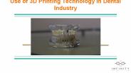 Use of 3D Printing Technology in Dental Industry