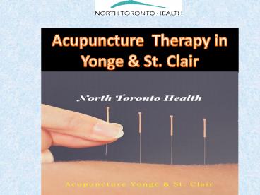 Best Healing therapy Acupuncture at Yonge & St. Clair