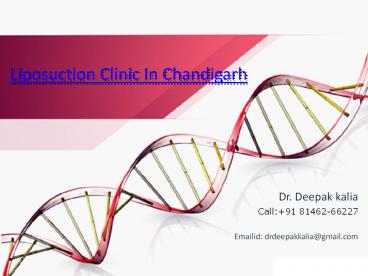 Liposuction in chandigarh (2)