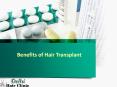 Benefits of doing Hair transplant PowerPoint PPT Presentation