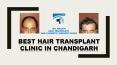 Best Hair Transplant Clinic in Chandigarh | Dr. Kalia's Cosmetic Surgery Clinic PowerPoint PPT Presentation