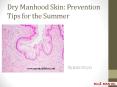 Dry Manhood Skin: Prevention Tips for the Summer PowerPoint PPT Presentation