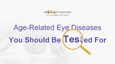 Age-Related Eye Diseases You Should Be Tested For