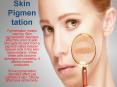 Skin Pigmentation (1) PowerPoint PPT Presentation