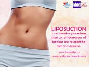 Weight Loss Surgery in Delhi