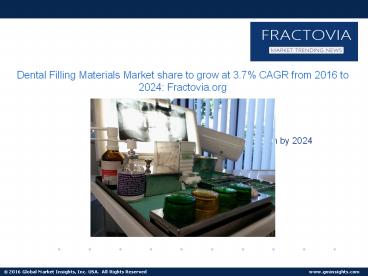 Dental Filling Materials Market by Product, Industry Analysis, Regional Outlook 2024