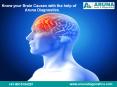 Know The Brain Causes with the help of Aruna Diagnostics PowerPoint PPT Presentation