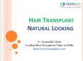 Best Hair Transplant Center in Delhi|Hair transplant doctor|Hair Transplant Clinic in South Delhi PowerPoint PPT Presentation