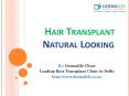 Best Hair Transplant Center in Delhi|Hair transplant doctor|Hair Transplant Clinic in South Delhi (1) PowerPoint PPT Presentation