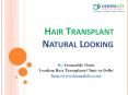 Best Hair Transplant Center in Delhi|Hair transplant doctor|Hair Transplant Clinic in South Delhi (2) PowerPoint PPT Presentation