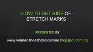 How To Get Ride of Stretch Marks