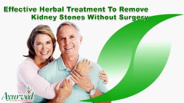 Effective Herbal Treatment To Remove Kidney Stones Without Surgery