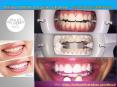 Dentist Teeth Cleaning Near Me - Smiles Delivered NYC PowerPoint PPT Presentation