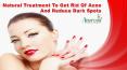 Natural Treatment To Get Rid Of Acne And Reduce Dark Spots PowerPoint PPT Presentation