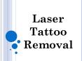 Laser Tattoo Removal