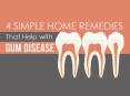 3 Helpful Tips for Preventing Periodontitis PowerPoint PPT Presentation