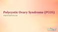 Polycystic Ovary Syndrome (PCOS) PowerPoint PPT Presentation