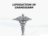 Body fat reduction in chandigarh