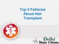 Top 5 Fallacies about hair transplant PowerPoint PPT Presentation