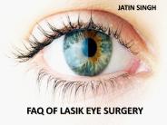 Lasik Eye Surgery FAQS