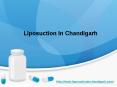 Liposuction in punjab PowerPoint PPT Presentation