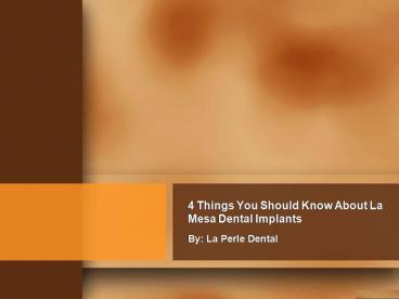 4 Things You Should Know About La Mesa Dental Implants