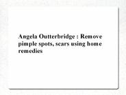 Angela Outterbridge-Remove pimple spots, scars using home remedies