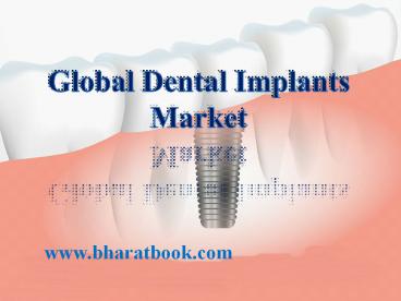 Global Dental Implants Market