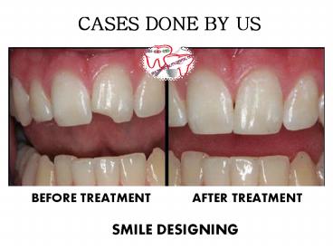 URJA MULTISPECIALITY DENTAL CLINIC (2)