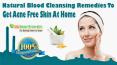 Natural Blood Cleansing Remedies To Get Acne Free Skin At Home PowerPoint PPT Presentation