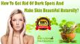 How To Get Rid Of Dark Spots And Make Skin Beautiful Naturally? PowerPoint PPT Presentation