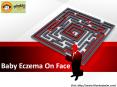 Baby Eczema On Face PowerPoint PPT Presentation