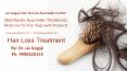 Medicine for best hair loss treatment