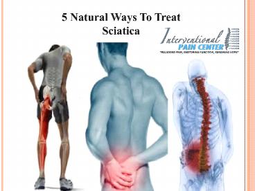 Sciatica Treatment Raleigh - Get Relief From Sciatica Within Few Days (1)