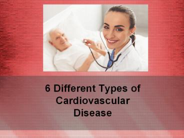 PPT – 6 Different Types of Cardiovascular Disease PowerPoint ...