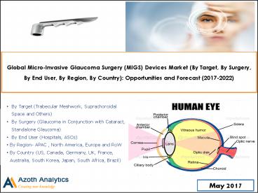 Global Micro-Invasive Glaucoma Surgery (MIGS) Devices Market : Opportunities and Forecast (2017-2022) - Azoth Analytics