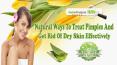 Natural Ways To Treat Pimples And Get Rid Of Dry Skin Effectively PowerPoint PPT Presentation
