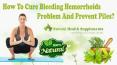 How To Cure Bleeding Hemorrhoids Problem And Prevent Piles? PowerPoint PPT Presentation