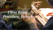 China Biopsy Procedures Outlook