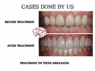 DENTAL TOURISM INDIA