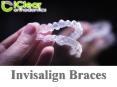 Invisalign Braces Roswell PowerPoint PPT Presentation