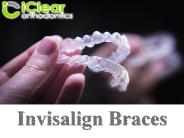 Invisalign Braces Roswell