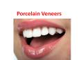 Porcelain Veneers PowerPoint PPT Presentation