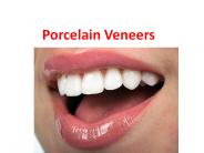 Porcelain Veneers